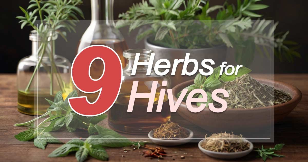 Herbs for Hives